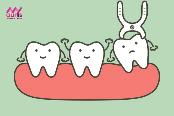 Khi nào nên nhổ răng khôn mọc lệch hàm dưới?