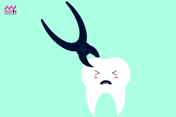 Nhổ răng khôn hàm trên có ảnh hưởng gì không -nhổ răng khôn hàm trên có nguy hiểm không?
