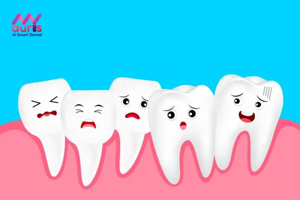 Tác hại của hàm răng dưới không đều