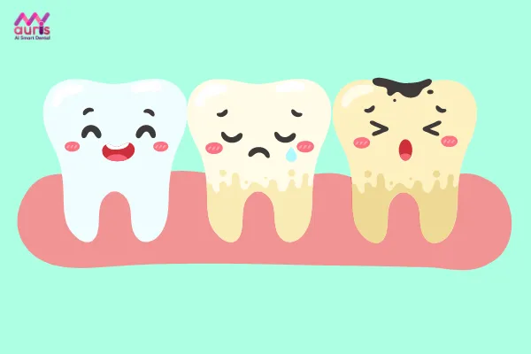 Trường hợp có nên nhổ răng số 8 hàm trên không? 