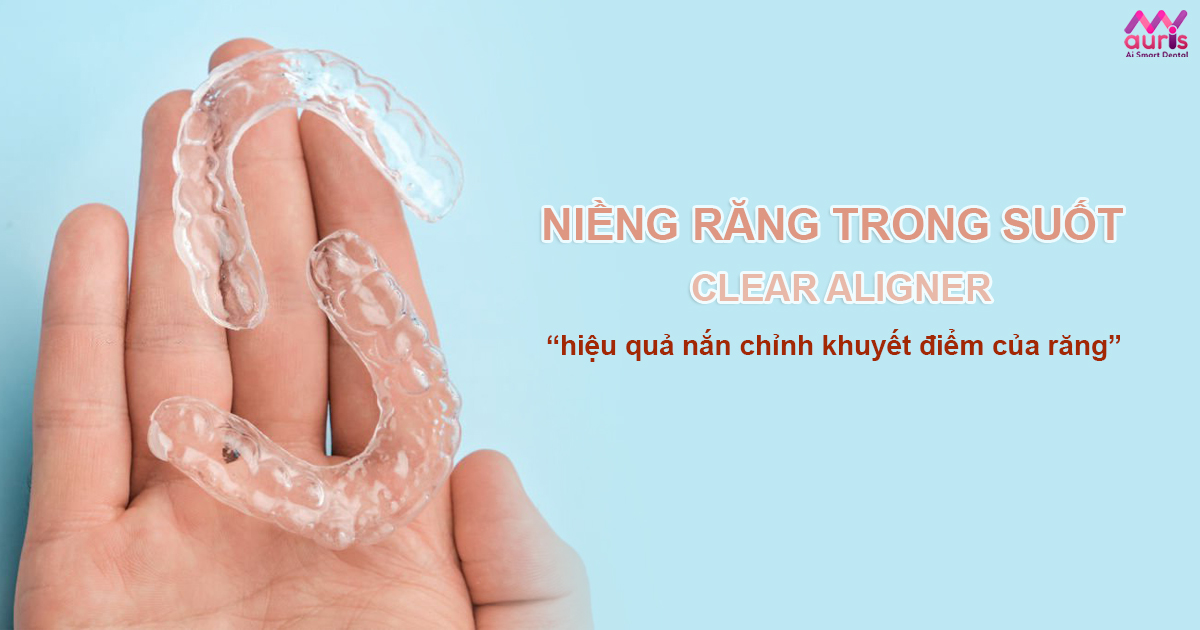 niềng răng trong suốt clear aligner