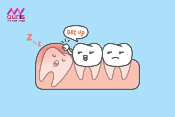 Tìm hiểu nhổ răng khôn mọc ngầm có đau không?