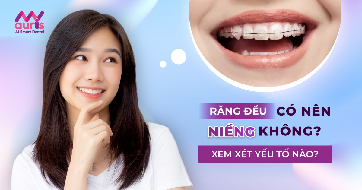 Răng đều có nên niềng không và cần xem xét những yếu tố nào?