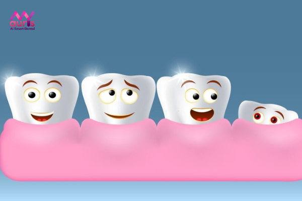 Yếu tố ảnh hưởng điều trị răng khôn mọc lệch ra má hàm dưới
