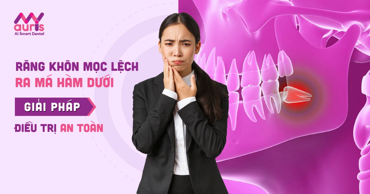 Tìm hiểu răng khôn mọc lệch ra má hàm dưới