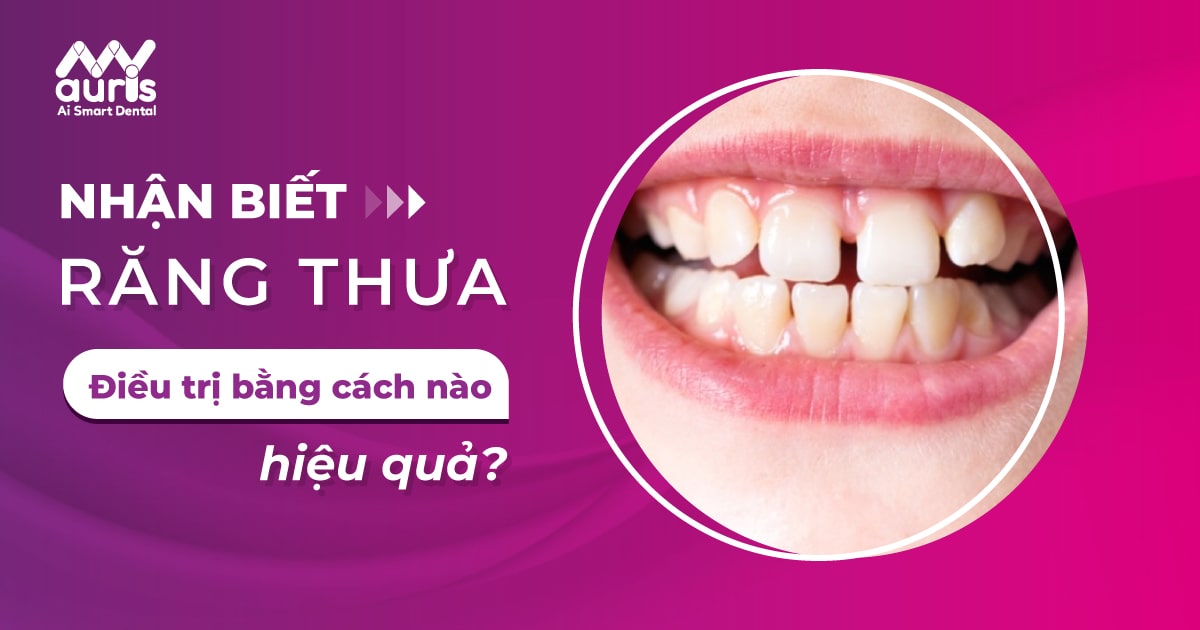 Răng thưa nên làm gì? Điều trị ở nha khoa là tốt nhất?