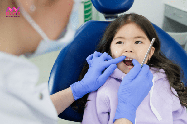 Cách xử lý khi trẻ bị gãy răng sữa 