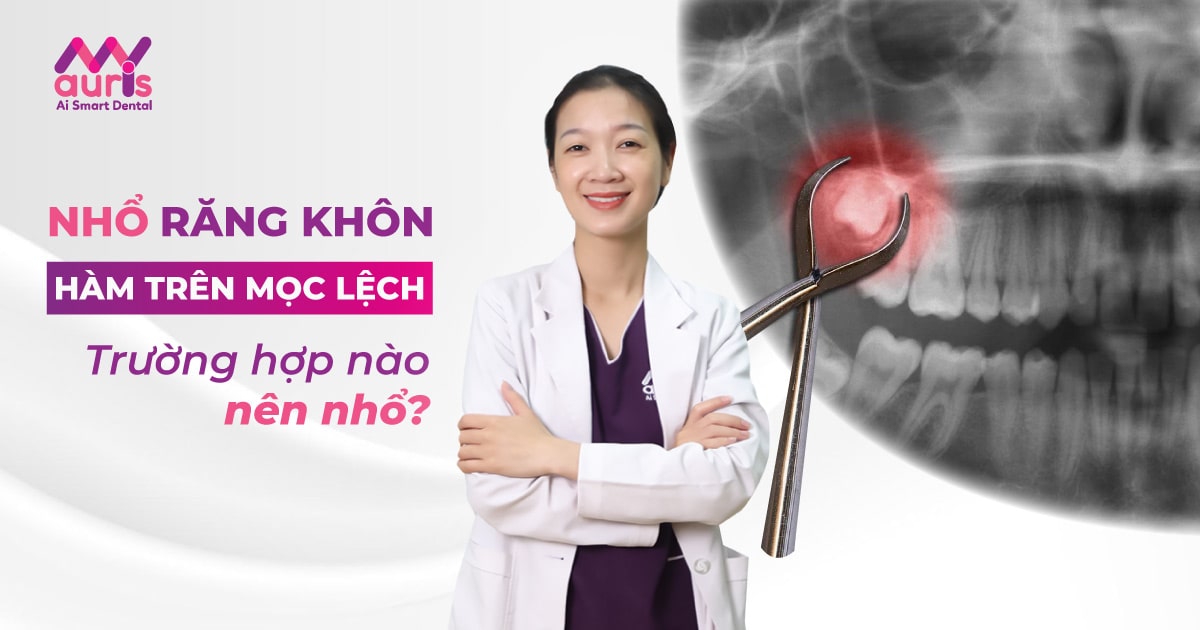 Trường hợp nào nên nhổ răng khôn hàm trên mọc lệch