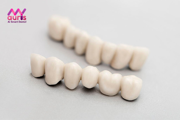 Điều trị răng cửa mọc lệch hàm trên bằng cách bọc sứ
