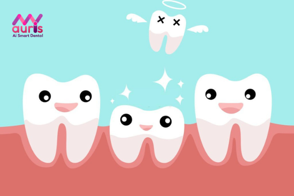 Răng cửa mọc lệch hàm trên sẽ có những dạng nào?