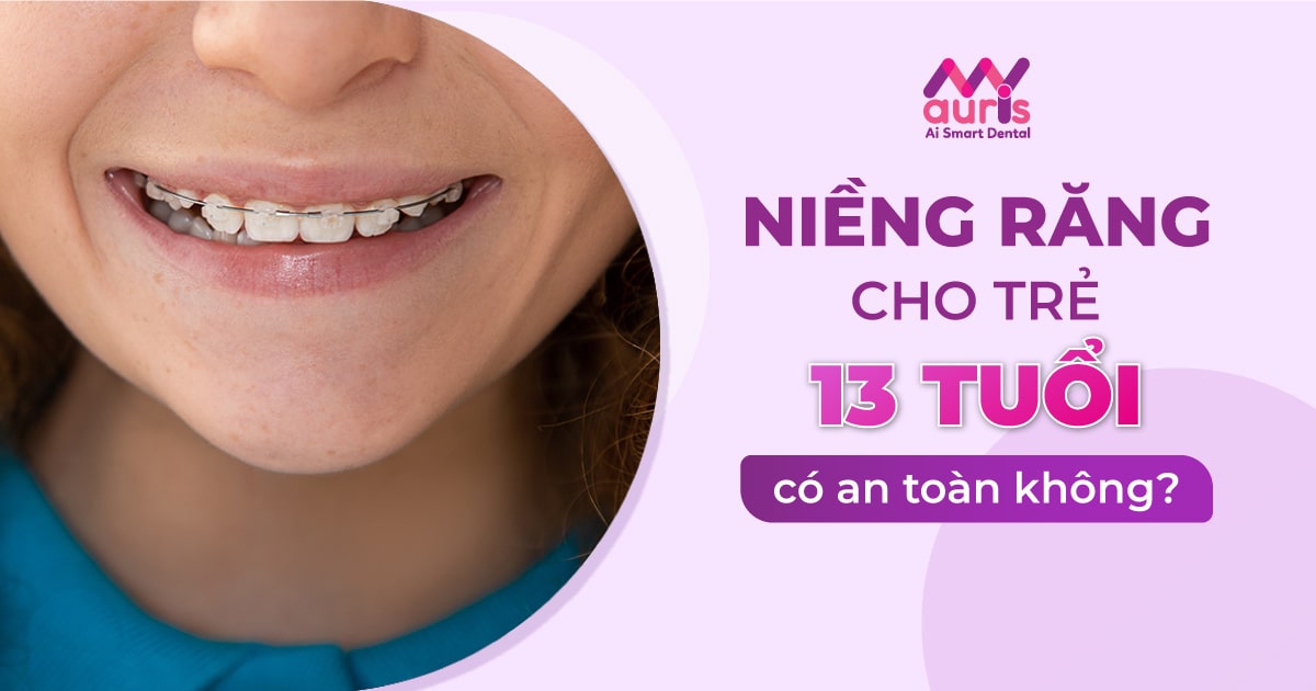 giá niềng răng cho trẻ 13 tuổi