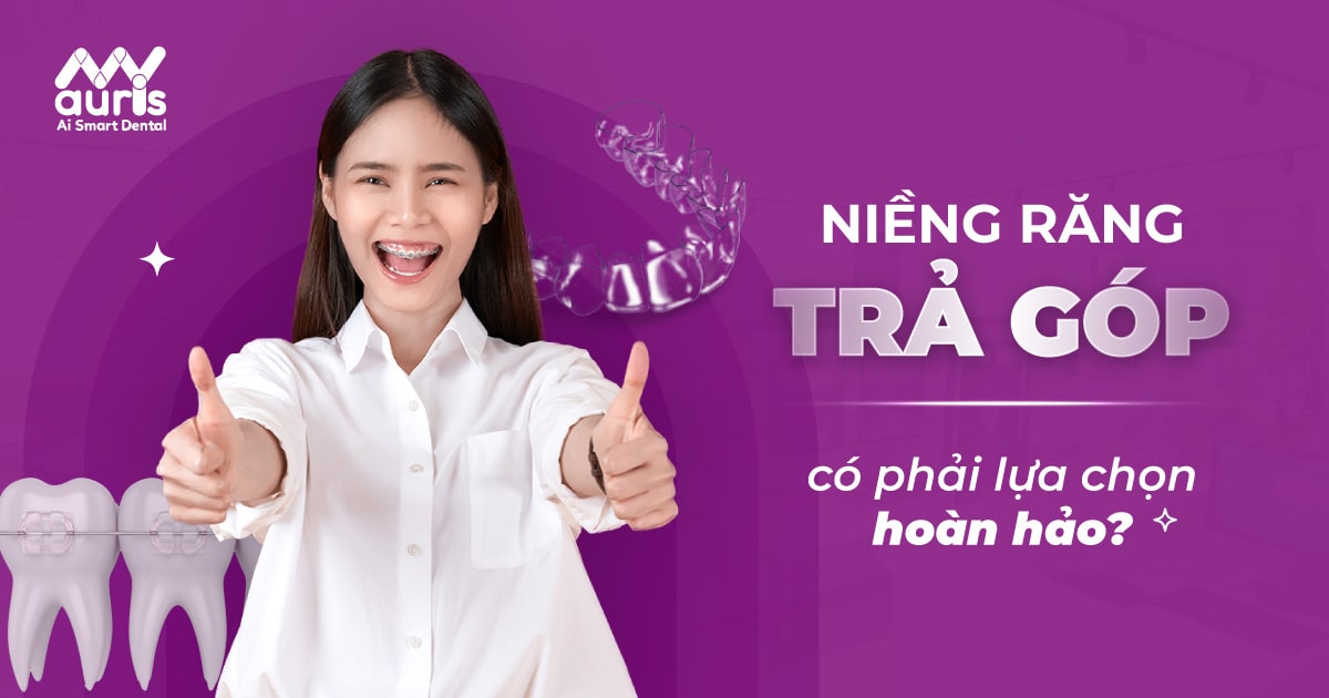 giá niềng răng trả góp