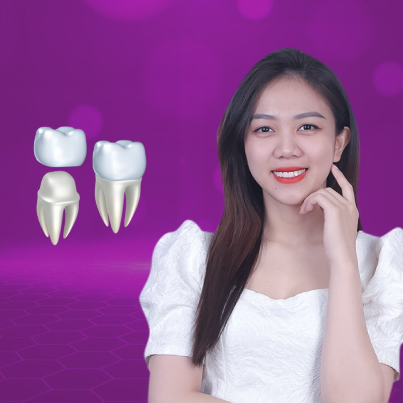 Bọc răng sứ là gì? Những tác hại và biến chứng nguy hiểm khi bọc răng sứ