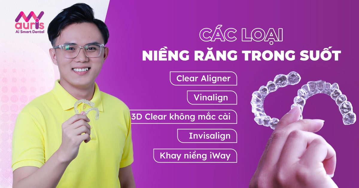 Các loại niềng răng trong suốt phổ biến ở nha khoa