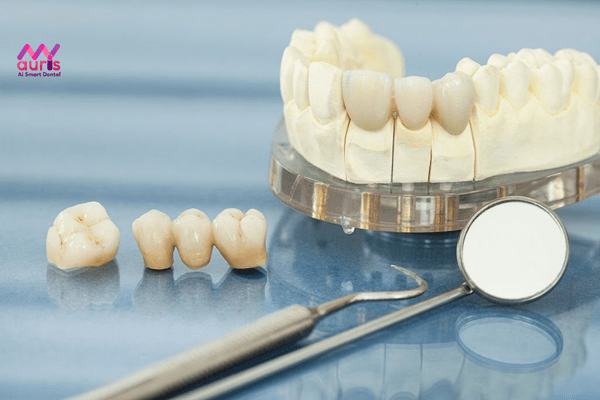 Chi phí bọc răng sứ bao nhiêu tiền một hàm