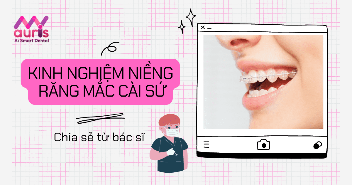 Chia sẻ kinh nghiệm niềng răng mắc cài sứ bạn cần biết