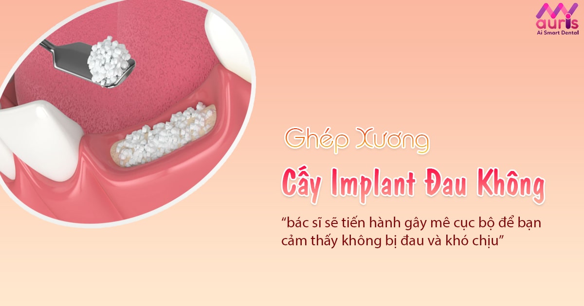 ghép xương cấy implant có đau không