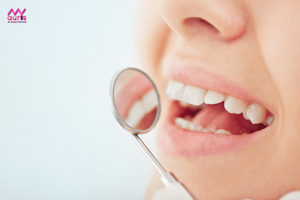 Răng hô nhẹ và những điều cần biết - giá tiền niềng răng hô nhẹ