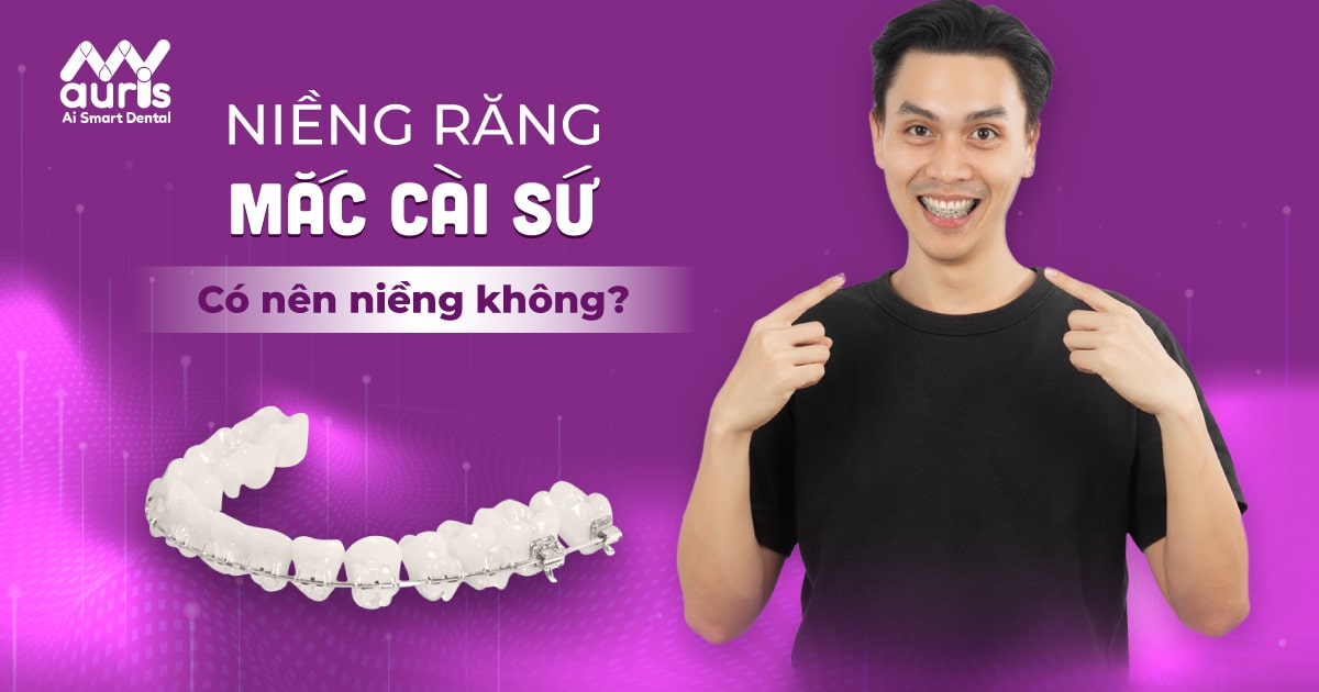 Giải đáp câu hỏi có nên niềng răng mắc cài sứ không?