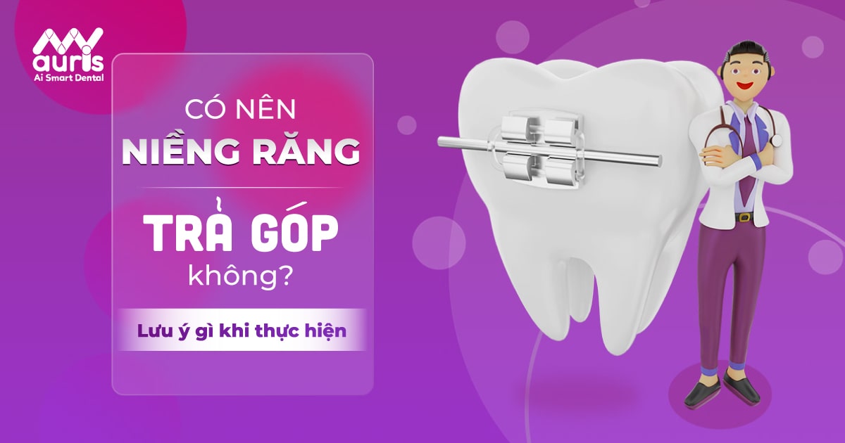 Giải đáp có nên niềng răng trả góp không và lưu ý gì?