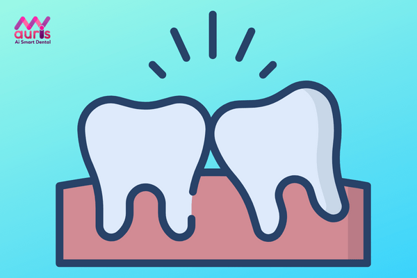 Thời điểm mọc răng khôn - mọc răng khôn hàm dưới bên trái có nên nhổ