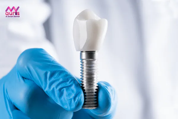 Kỹ thuật trồng răng implant diễn ra như thế nào? 