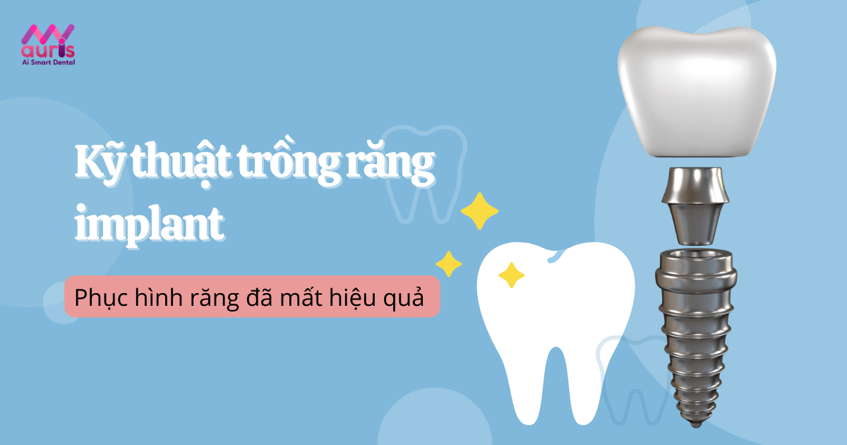 kỹ thuật trồng răng implant