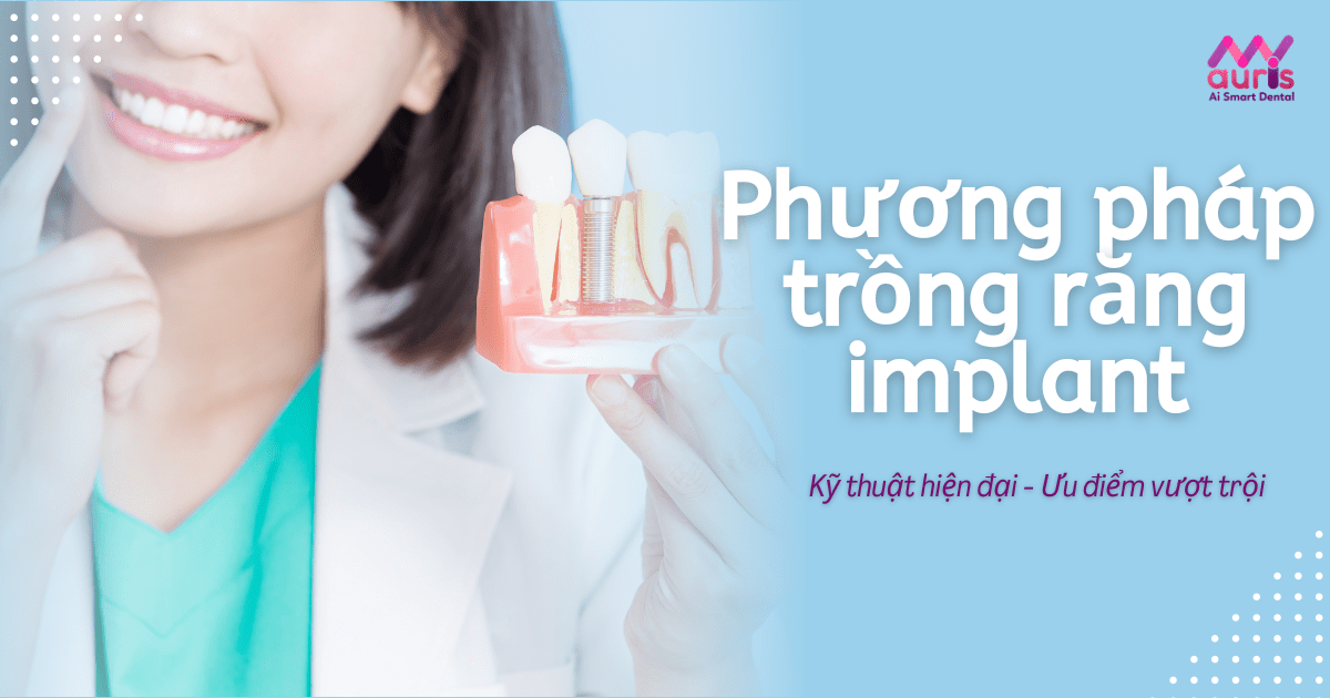 Những gì cần biết về phương pháp trồng răng implant