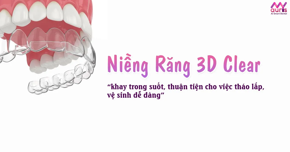 niềng răng trong suốt 3D Clear