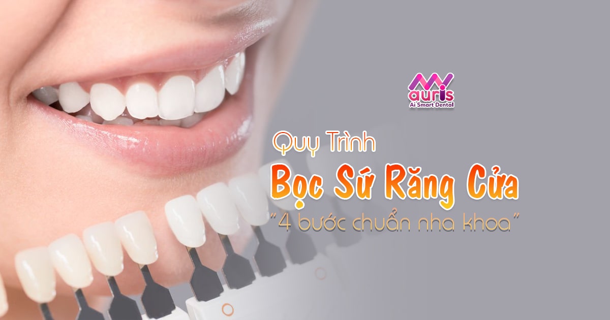 quy trình bọc răng sứ cho răng cửa