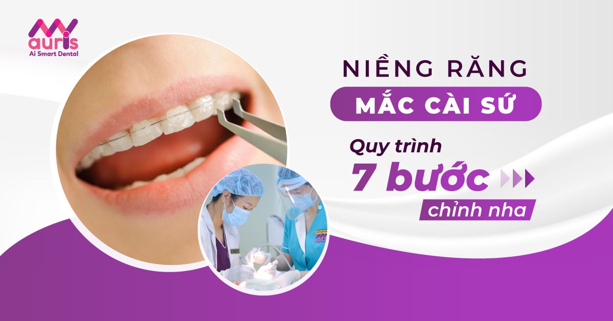 Niềng răng mắc cài sứ giá rẻ có quy trình mấy bước?