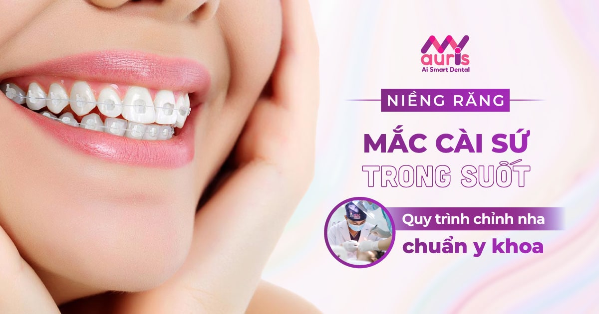 Tìm hiểu quy trình niềng răng mắc cài sứ trong suốt