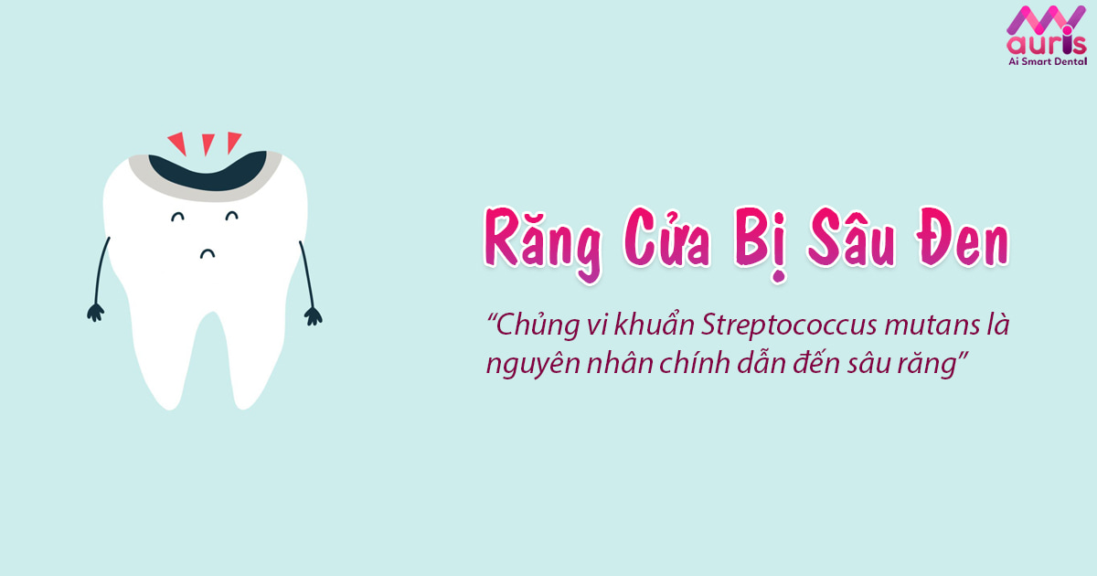 răng cửa bị sâu đen