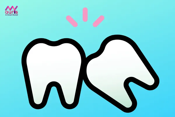 Răng khôn là gì? Tác hại của răng khôn