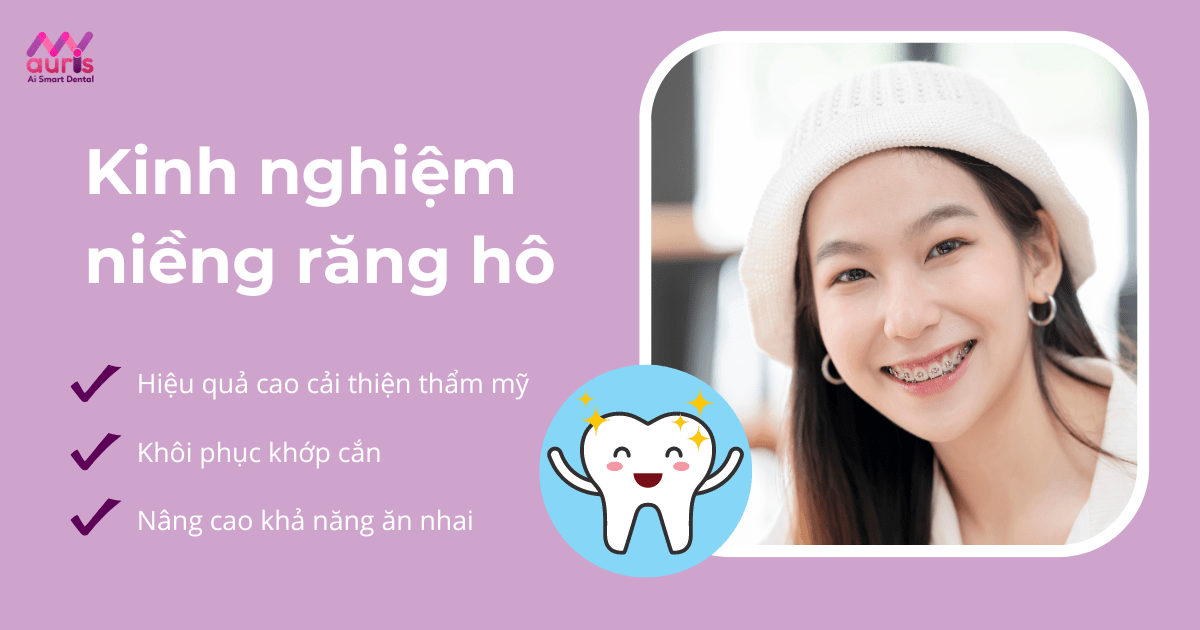 Tất tần tật kinh nghiệm niềng răng hô đạt hiệu quả cao