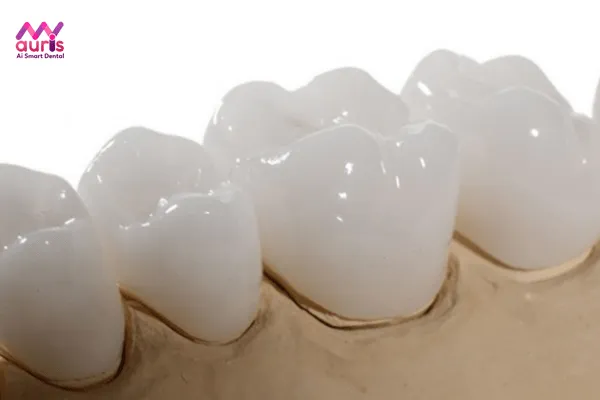 Đối tượng nên bọc răng sứ venus - có nên bọc răng sứ venus? 