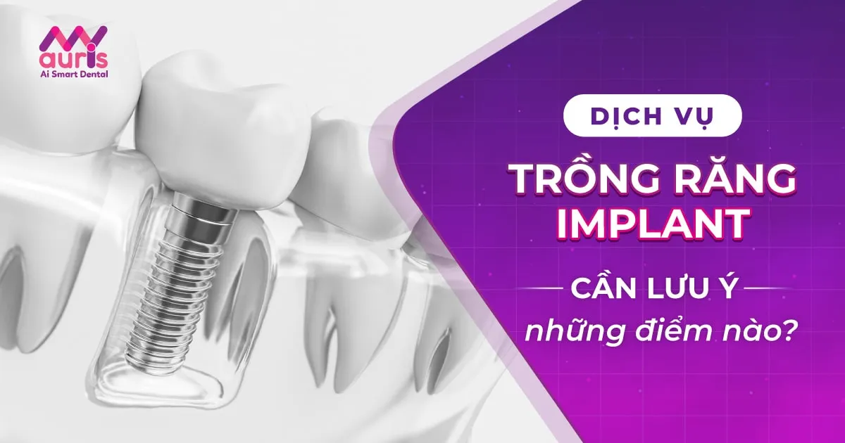Tìm hiểu dịch vụ trồng răng implant và điều lưu ý