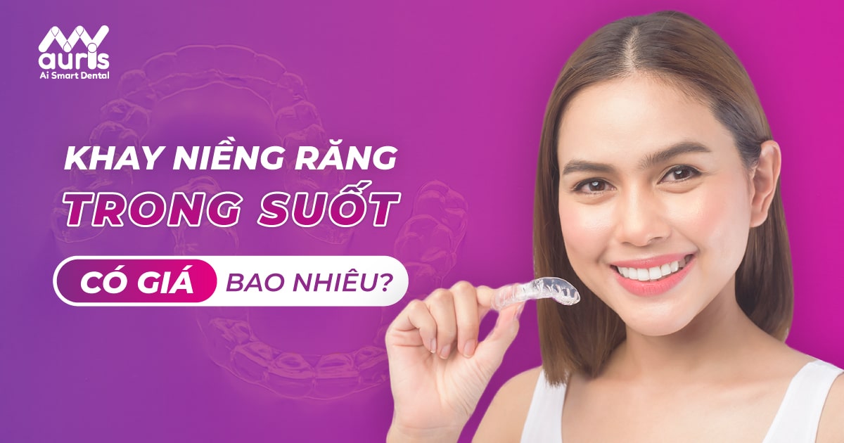 Tìm hiểu khay niềng răng trong suốt giá bao nhiêu?