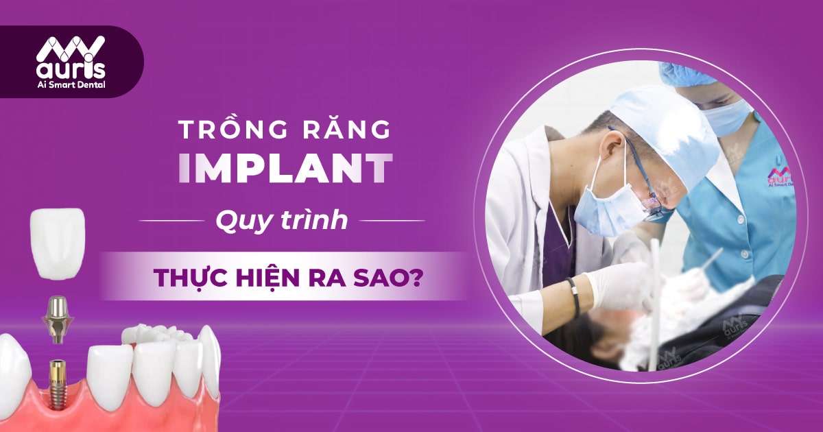 Tìm hiểu về trồng răng Implant và quy trình thực hiện