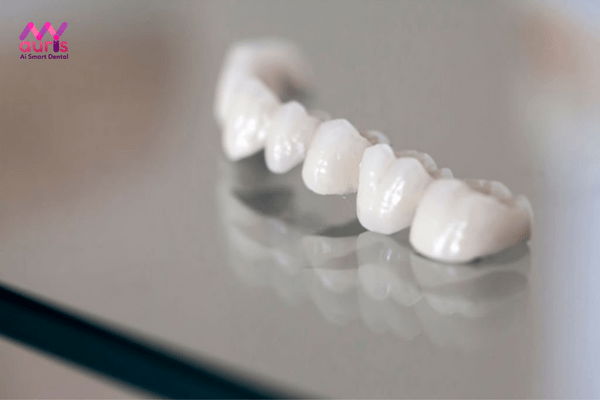 Răng sứ có mấy loại? giá bọc răng sứ bao nhiêu tiền