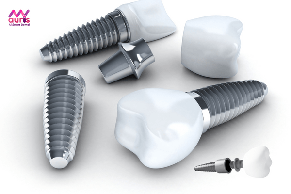 Tiêu chí chọn trồng răng implant loại nào tốt?