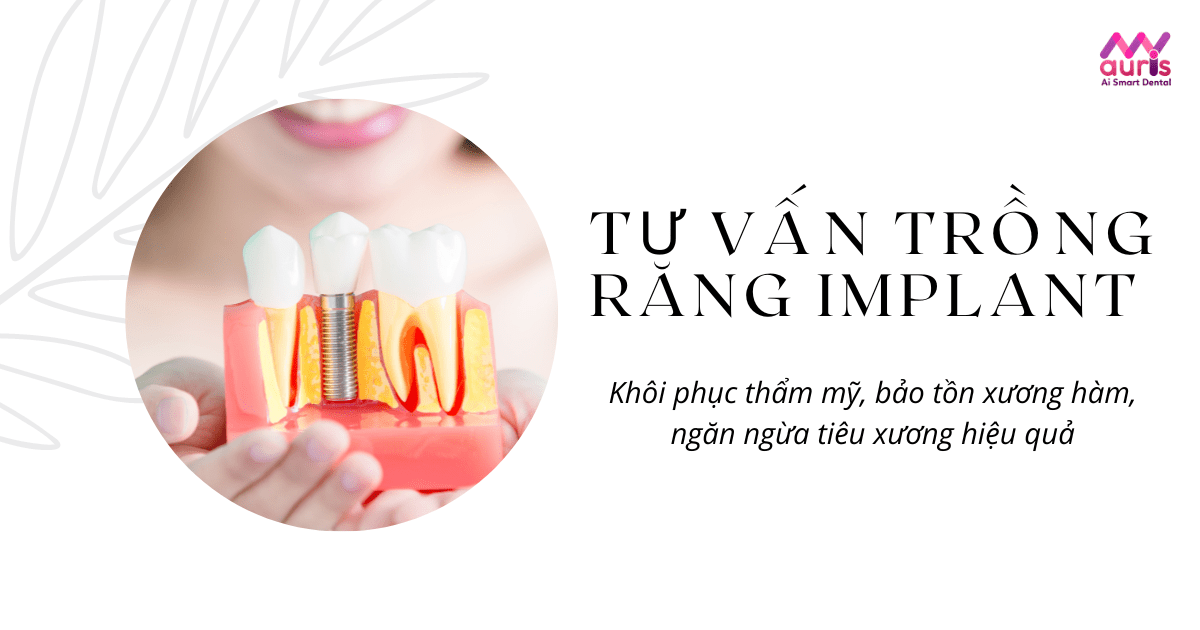 Tư vấn trồng răng implant trước khi thực hiện