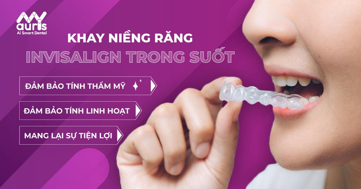 Khay niềng răng Invisalign trong suốt có ưu nhược điểm gì?