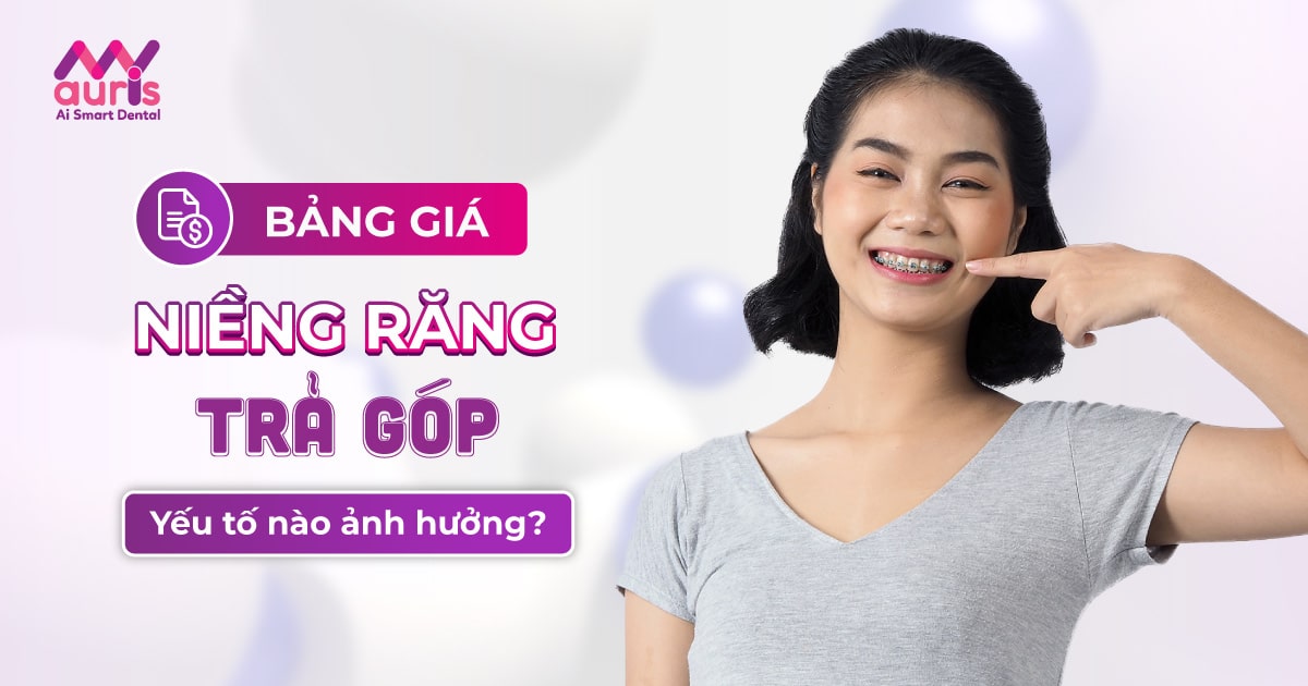 Yếu tố ảnh hưởng bảng giá niềng răng trả góp