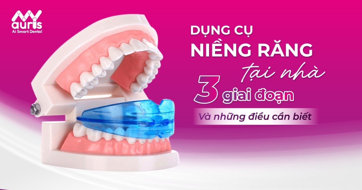 dụng cụ niềng răng tại nhà 3 giai đoạn