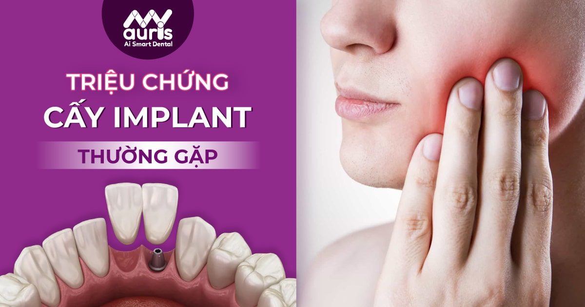 triệu chứng sau khi cấy implant