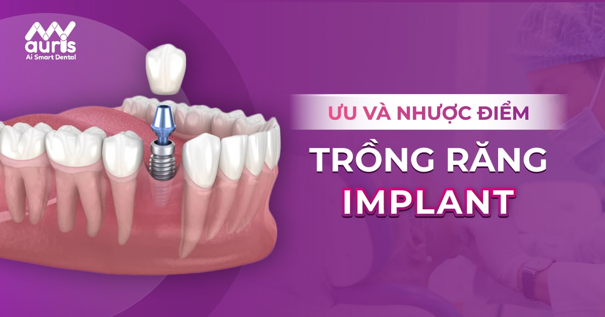 ưu nhược điểm của trồng răng implant