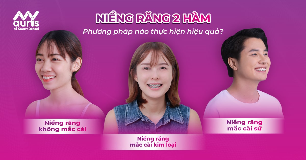 chi phí niềng răng 2 hàm