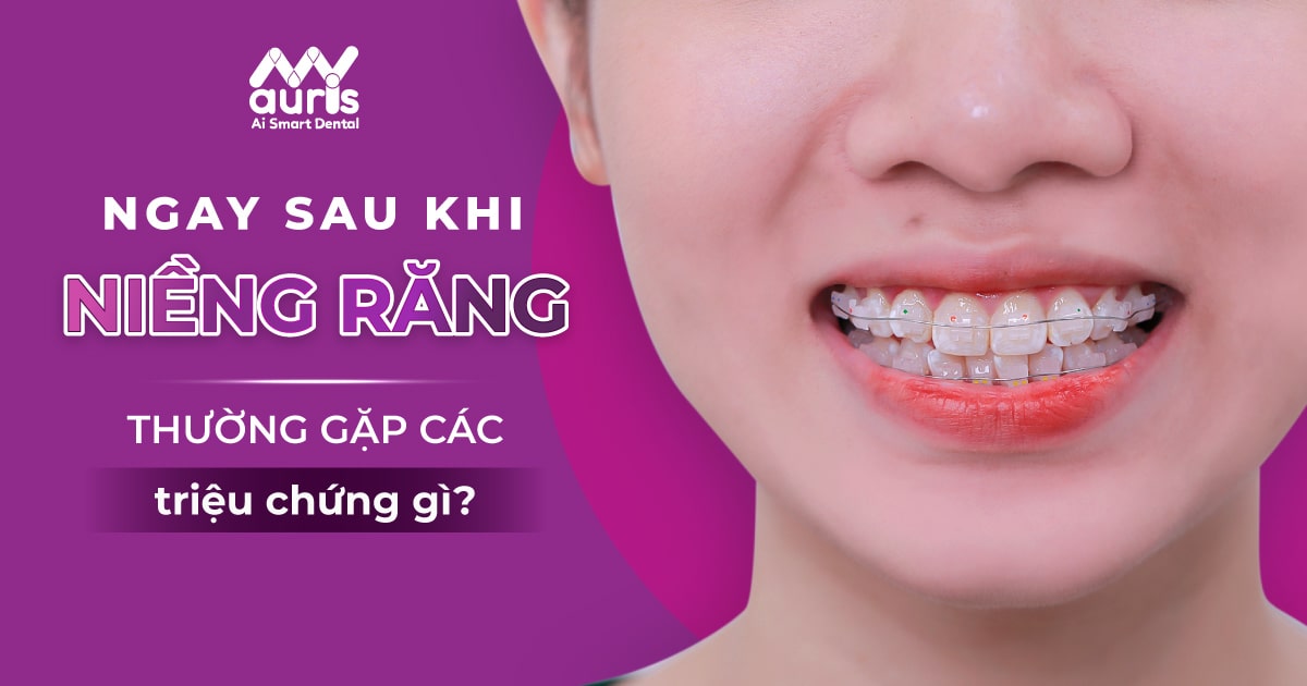 mới niềng răng có đau không