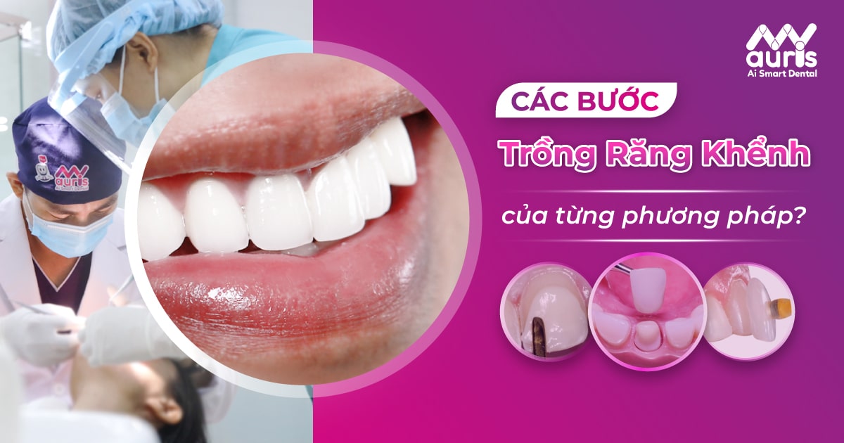 cách trồng răng khểnh